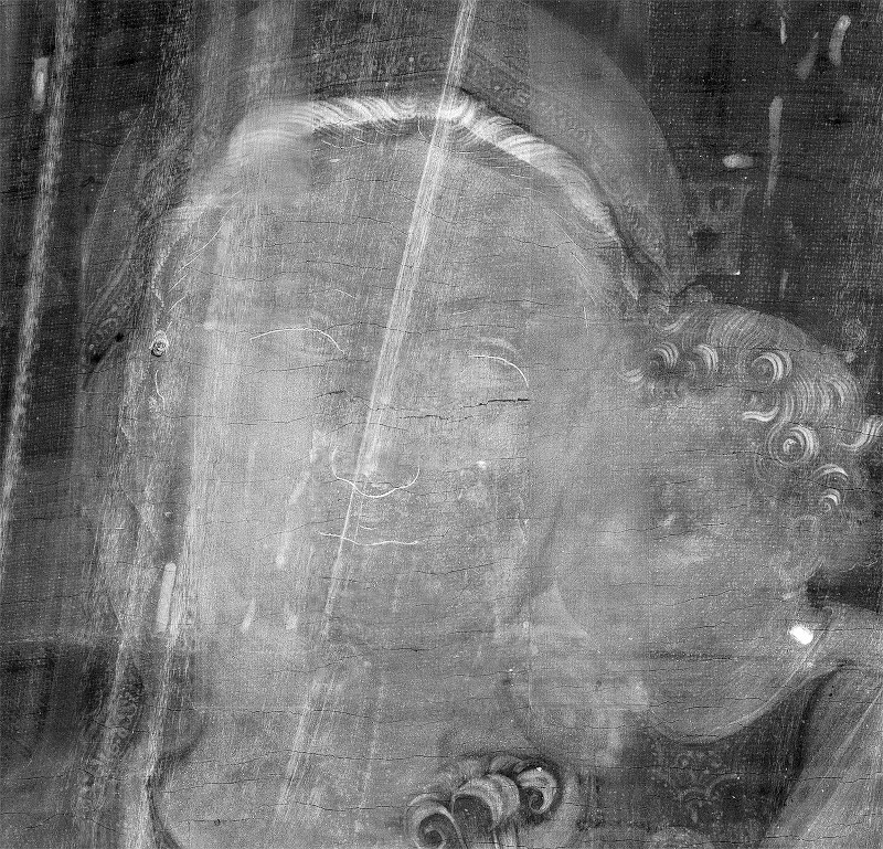 Detail in RX of the incisions of the face