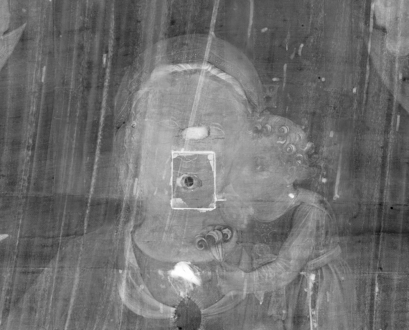 Detail of the X-ray showing the damage