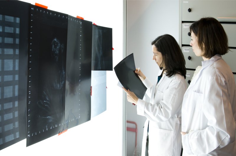 Proceso de estudio de la radiografía en el negatoscopio
